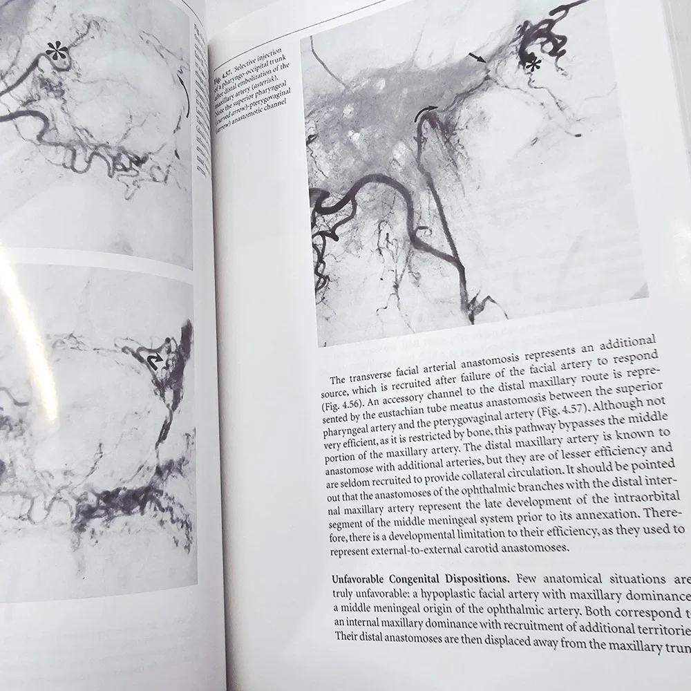 Springer Surgical Neuro-angiography 1 Clinical Vascular Anatomy‎ 2nd Ed GD